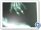 Röntgenbilder Vorderpfoten